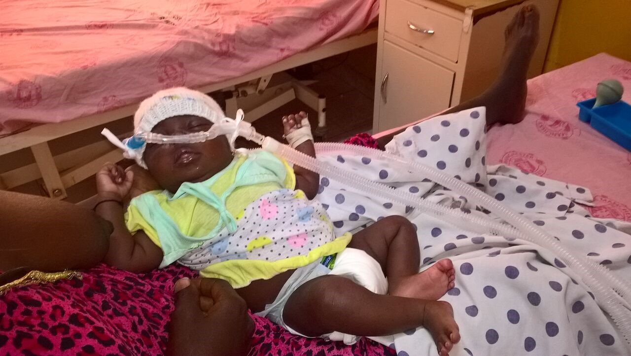 Baby with medical equipment