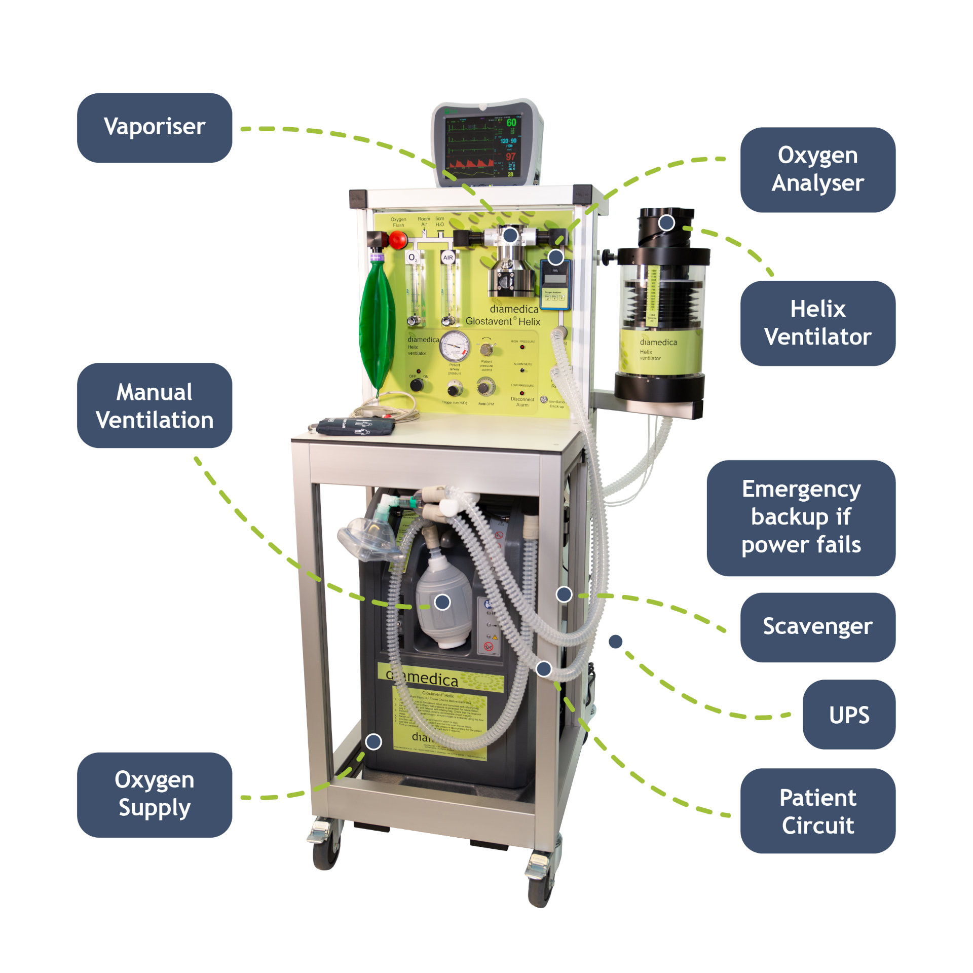 Glostavent Helix with Labels